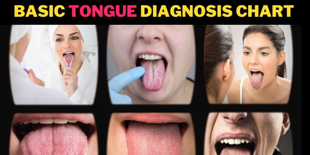 Basic Tongue Diagnosis Chart