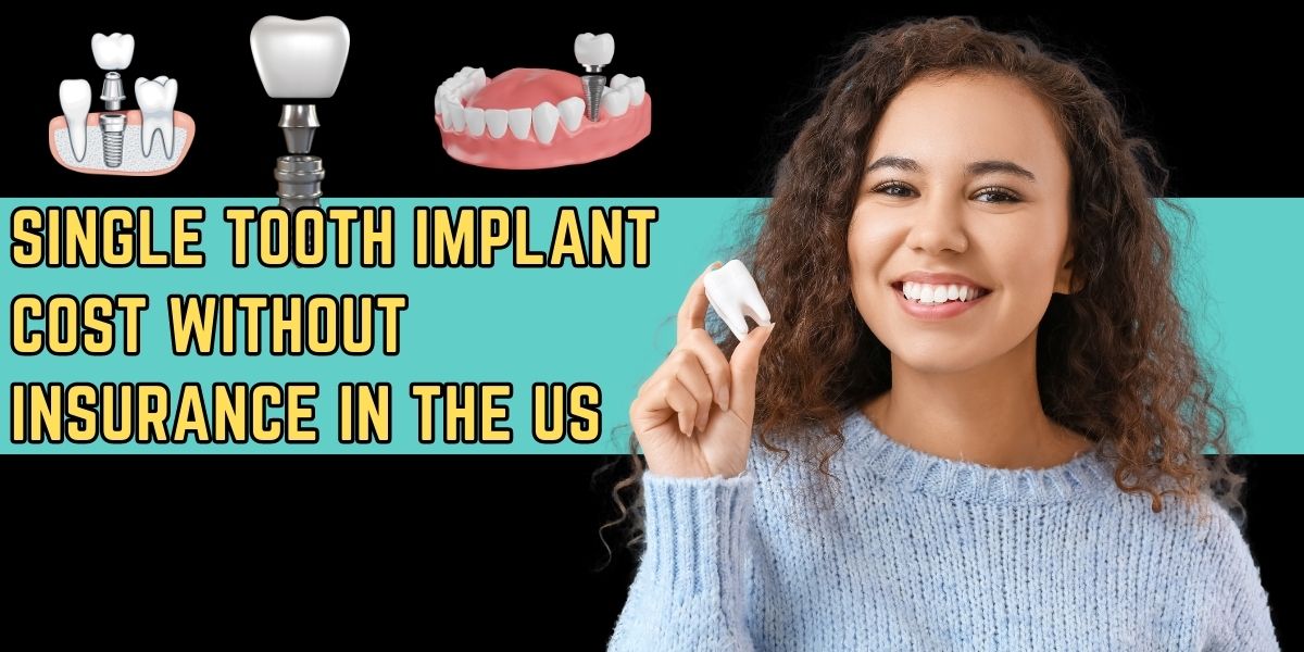 How Much Does A Single Tooth Implant Cost Without Insurance In The US?
